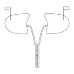 Cessna A185F (1973-1985) Cowl Plugs W/ Rbf Streamer (color: Red). Fixed Price $169.95.
